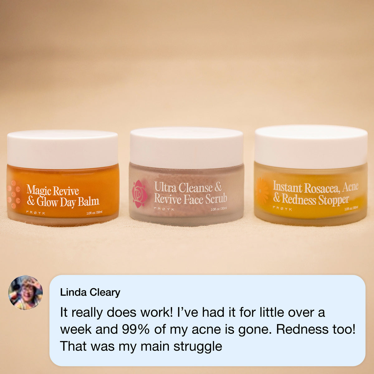 Frøya Organics Complete Acne System for Women in glass jar with lid – 4-step acne system front view